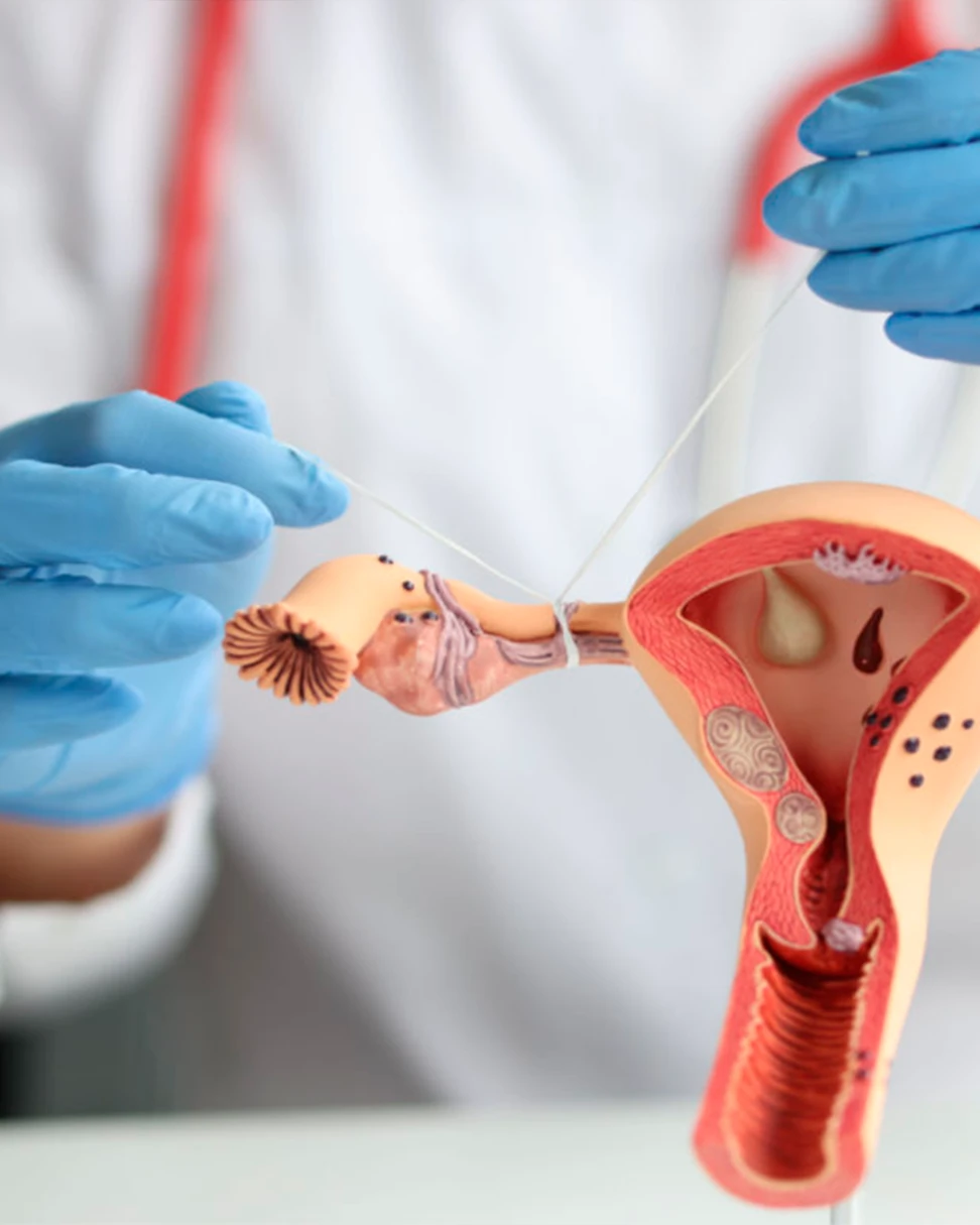 Cirurgias Ginecológicas